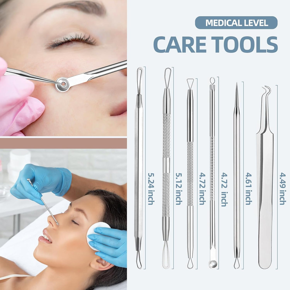 Blackhead Remover Tools – Precision Acne Extractor Set That Protects Sensitive Skin from Damage