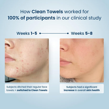 Clean Skin Club Clean Towels® – Travel-Sized Face Towels for Carry-On and Hotel Use, 25 Ct