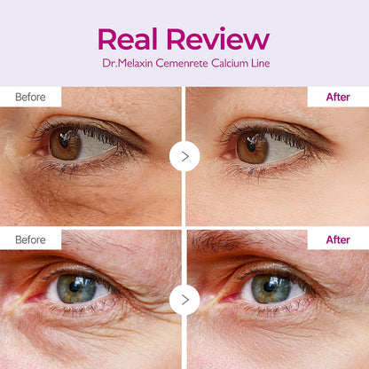 multi-care patch shape engineered for undereye, forehead, and nasolabial (smile line) zones