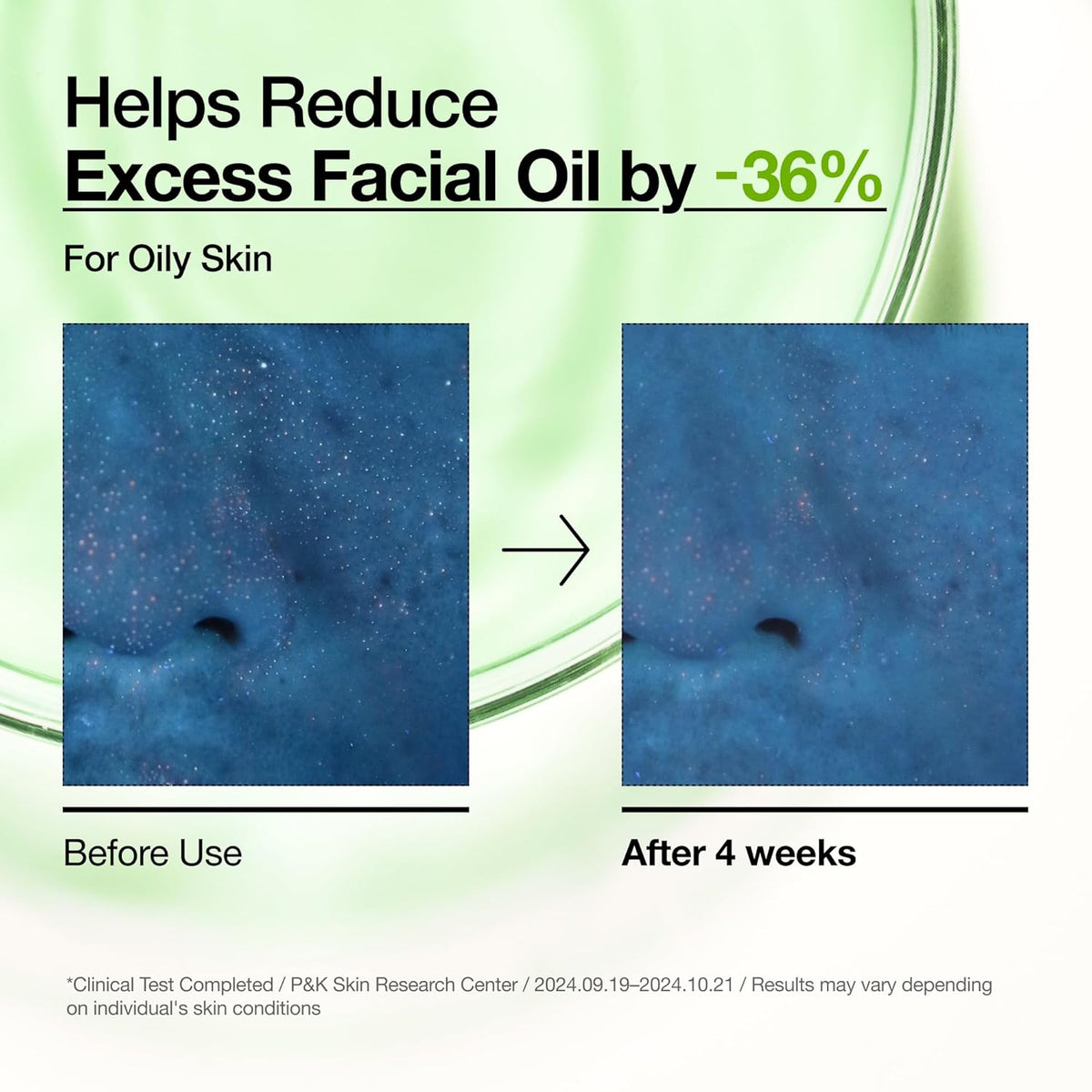 non-comedogenic, fragrance-free, lightweight watery serum texture in a 1.01 fl oz bottle
