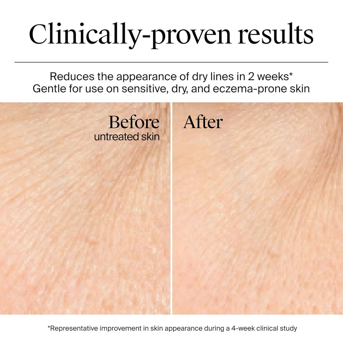 non-comedogenic gel-cream texture that absorbs without greasiness
