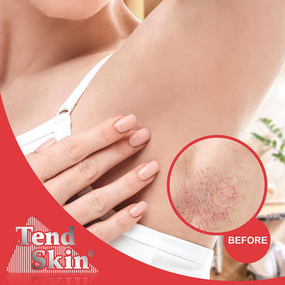 suitable for all skin types